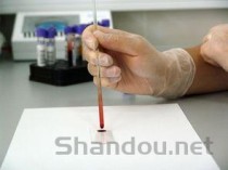 能用靶向药是好事还是坏事，为什么熟人医生不建议放疗